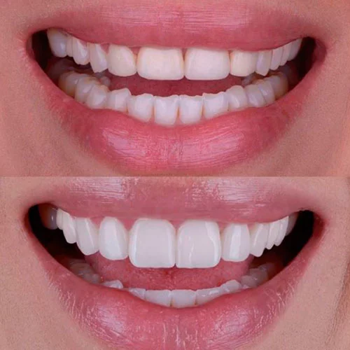 Diseño-sonrisa